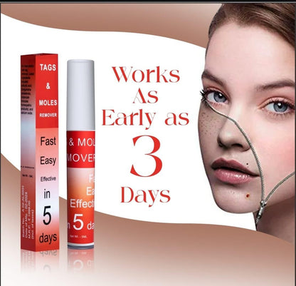 LOVILDS™ Tags & Moles Remover (Buy 1 Get 1 Free🔥🔥)