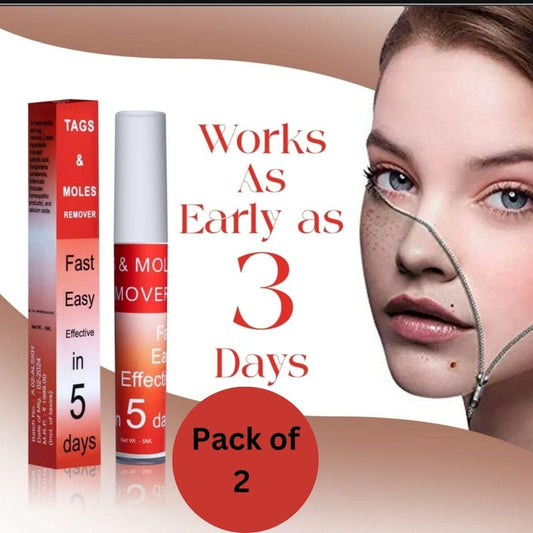 LOVILDS™ Tags & Moles Remover (Buy 1 Get 1 Free🔥🔥)